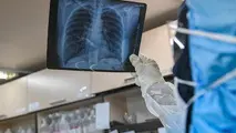 خطر اوج مجدد کرونا در کشور/ افراد بی‌علامت هم ماسک بزنند
