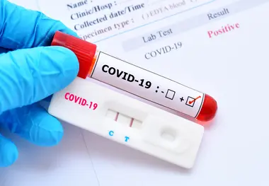 Travelers faking COVID-19 test results to fly