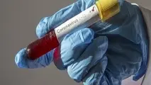 جدول توزیع مبتلایان کرونا تا ساعت ۱۲ روز ۱۴ اسفند طبق آمار دانشگاه‌های علوم پزشکی