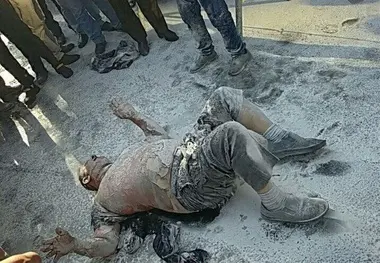 توضیحات شهردار منطقه دو درباره فرد خودسوزی کننده مقابل شهرداری