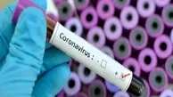 ژاپن گام اول را برای ساخت واکسن کرونا برداشت