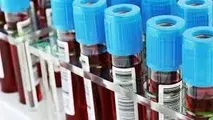 تشخیص زودهنگام آلزایمر با مطالعه روی پروتئین‌های خون

